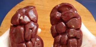 Ile warta jest nerka kota?