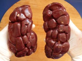 Czy nerka zalicza się do bagażu podręcznego?